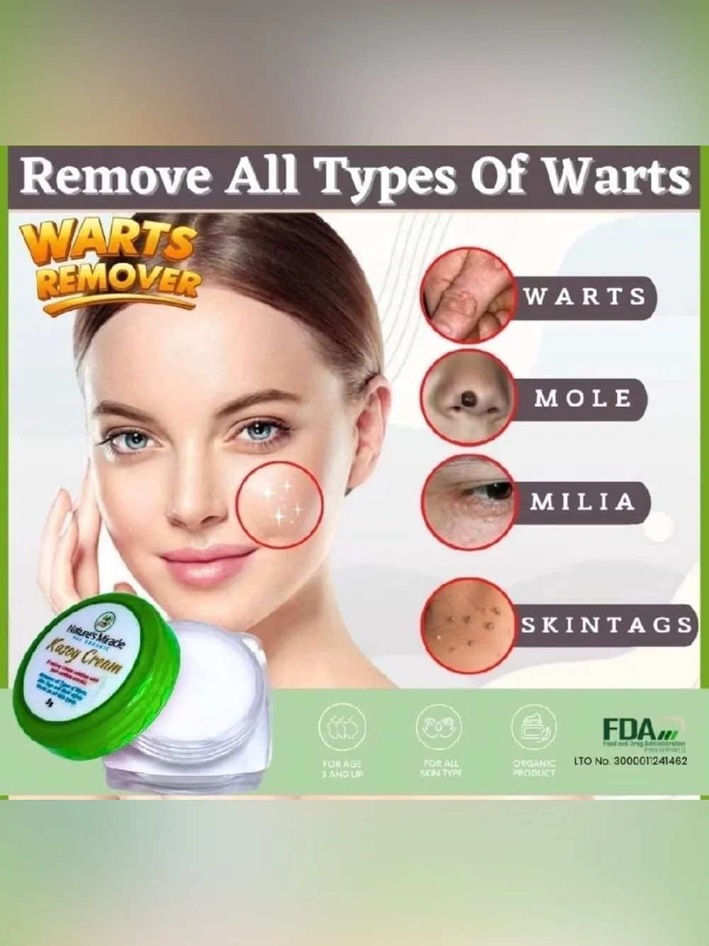 Kasoy Cream - Wart Remover and Skin Tags